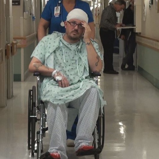 Lynch suffered a fractured skull in the attack. Lynch suffered a fractured skull in the attack.