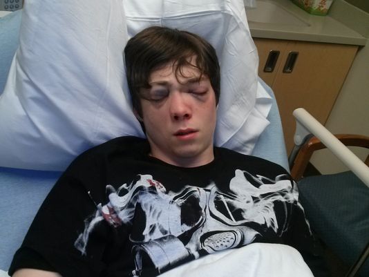 The thug has been charged as a juvenile for the violent and cowardly attack.