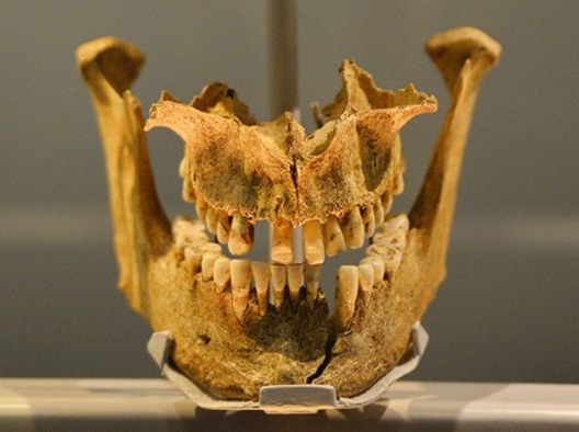 It would have been excruciatingly painful to file down these teeth. It would have been excruciatingly painful to file down these teeth.