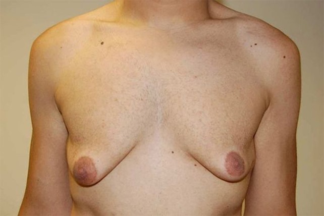 29889manboobs3 29889manboobs3