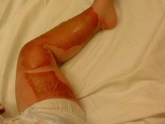 1403040912000-damon-gaddis-injury 1403040912000-damon-gaddis-injury