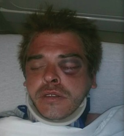 beaten_12997 beaten_12997