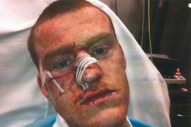 Injury-jpeg Injury-jpeg