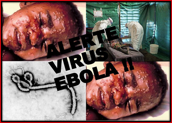 1609503_ebola_jpeg807d3eaa2d29e89e0785ebe20f1b0ba0 1609503_ebola_jpeg807d3eaa2d29e89e0785ebe20f1b0ba0