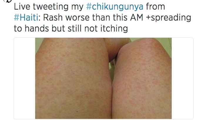 chikungunya2