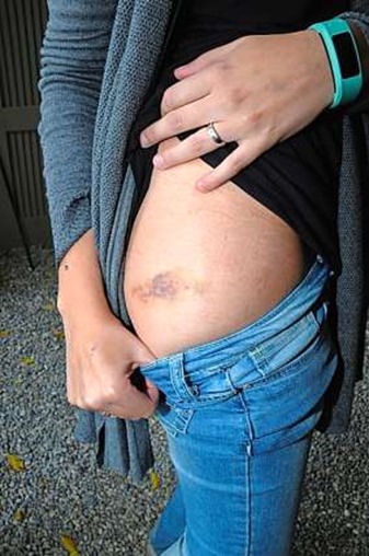 ueberfall-aarau00001 ueberfall-aarau00001