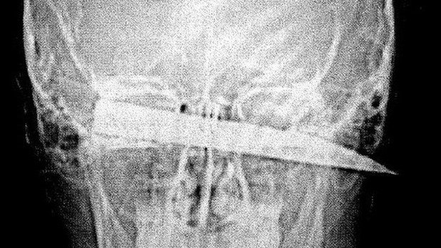 _80998027_80998026 _80998027_80998026