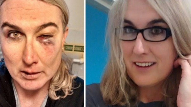 Transphobia made a real mess of this weirdo's makeup. 