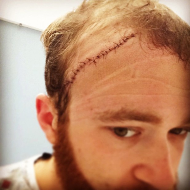 Scar will probably look cool. 