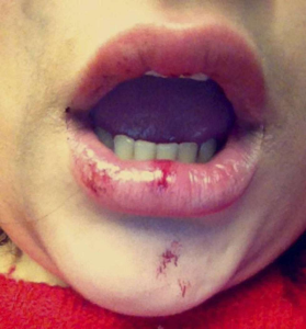 Ida-Attacked-279x300