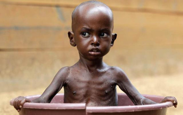 starving-child