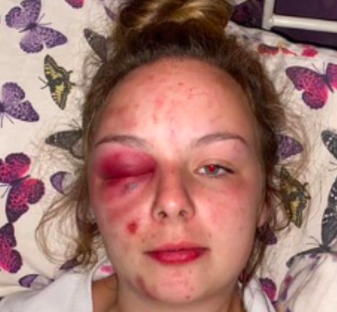 UK: Teenage Girl Walks Into Police Station, Shows Wounds, Denounces Pakistani Sex Gang