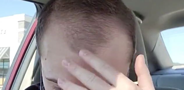 21-Year-Old F-to-M Tranny on the Verge of Suicide Whines About Hair Loss!