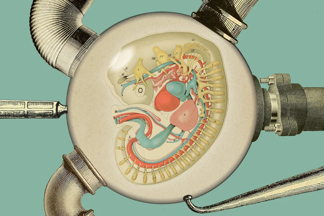 Woman in a Coma Since She was 3 Delivers Healthy Baby After Black Takes Advantage of Unused Womb