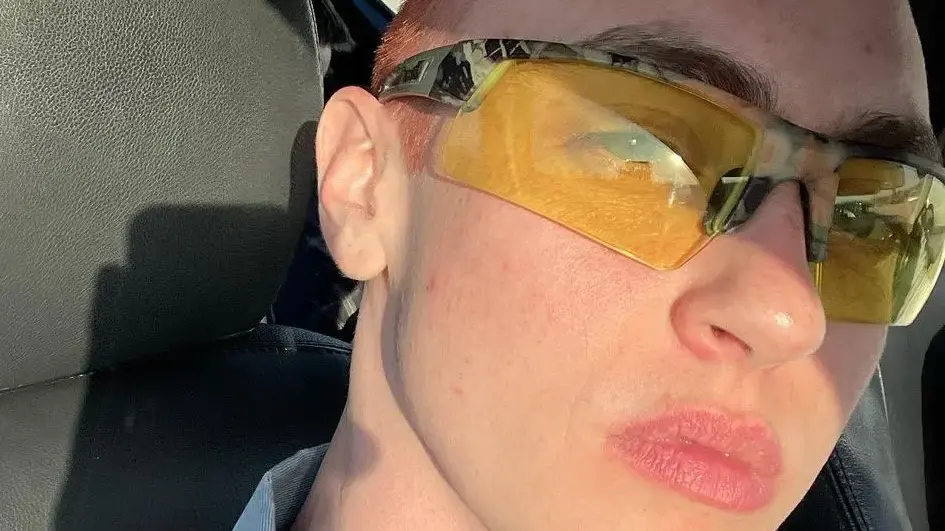 Woman Model Ruins Her Career by Taking Testosterone, Sues Agency for Not Doing Magic