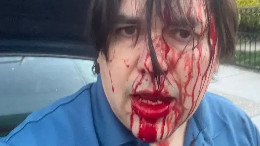 Watch: Teen Punks Assault Uber Driver During Attempted Robbery