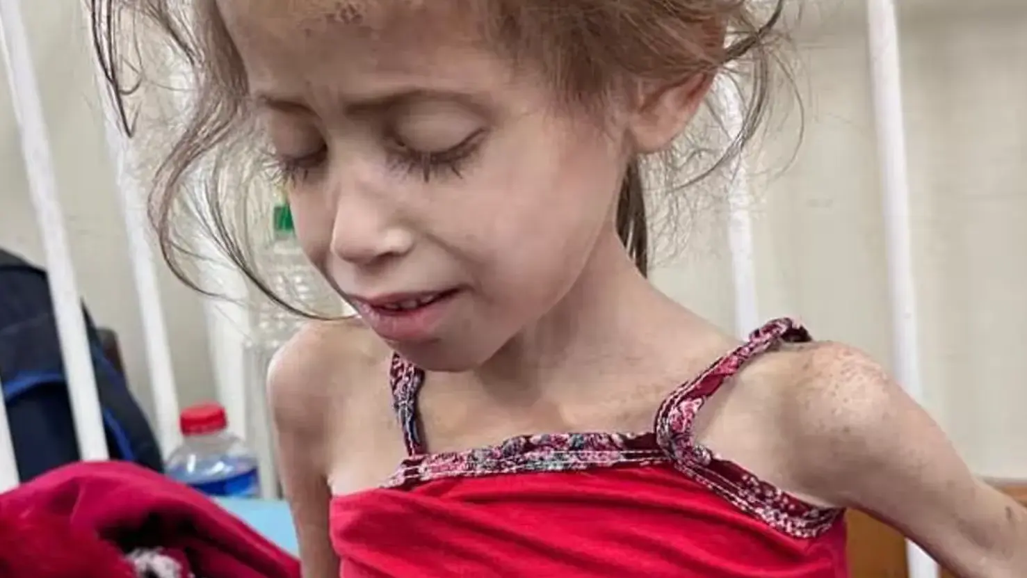 Gaza: Famine Killing Dozens of Babies and Children, Irreparably Damaging Countless Others