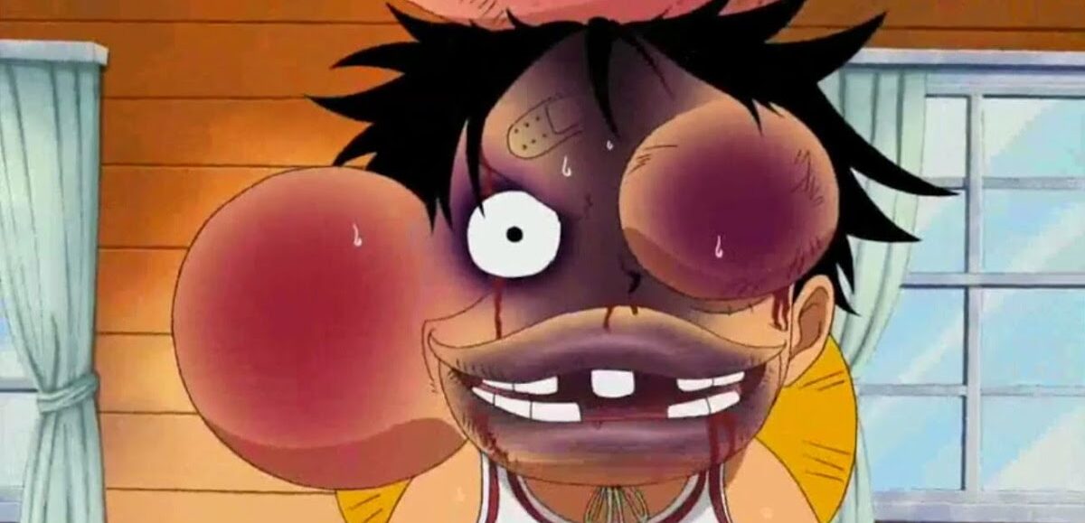 Germany: Political Violence Suddenly a Bad Thing After It Happens to Politician from Ruling Party