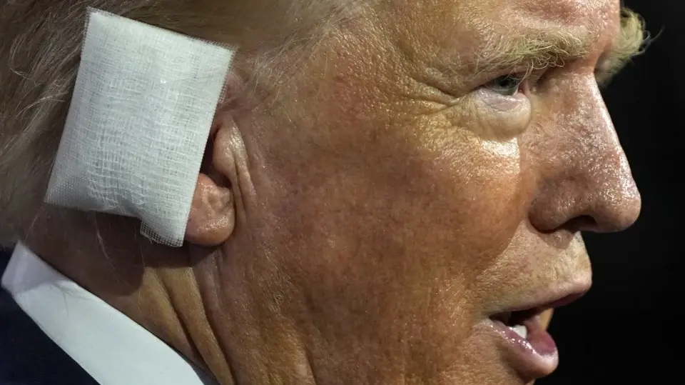 Trump Wears Ear Bandage at RNC as Republicans Say Divine Intervention Saved Him