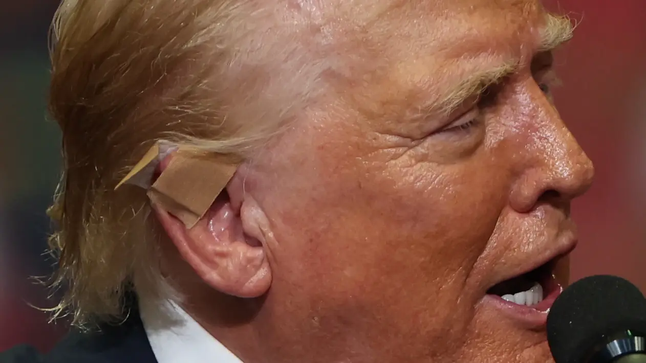 Conservatives Whine After FBI Director Says Shrapnel Could Have Caused Trump Ear Scratch