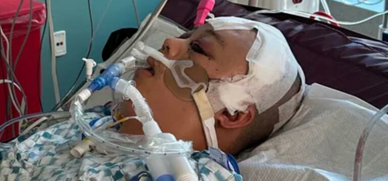 California: Chinaman Hit in the Head by Stray Bullet While Sleeping in His Own Home