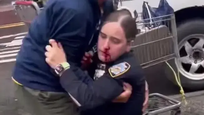 Female Cop Punched by Black Man has “Long Road to Recovery”